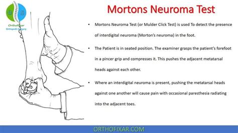 metatarsal head compression test|mulder's click test.